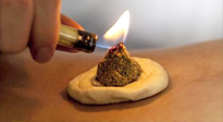 【艾灸知識(shí)】十大常見艾灸不良反應(yīng)，及處理方法！建議收藏！